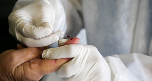 Estudo Sorológico de infecção por Covid-19 será iniciado nesta segunda (27) no Maranhão