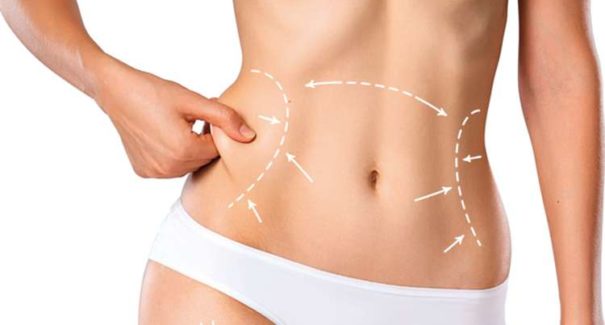 Lipo LAD ou HD: Conheça procedimento queridinho das celebridades
