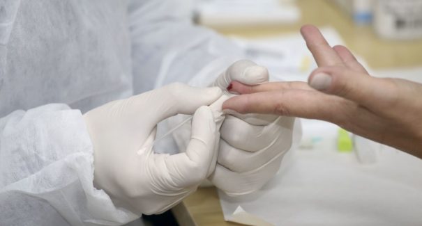 OMS: testes populacionais amplos de covid-19 nem sempre são úteis