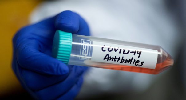 Maranhão registra mais 729 novos casos e 11 óbitos por Covid-19