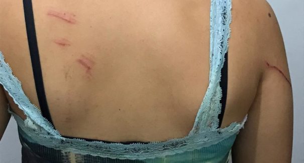 Mulher é agredida por companheiro e empurrada em cerca de arame
