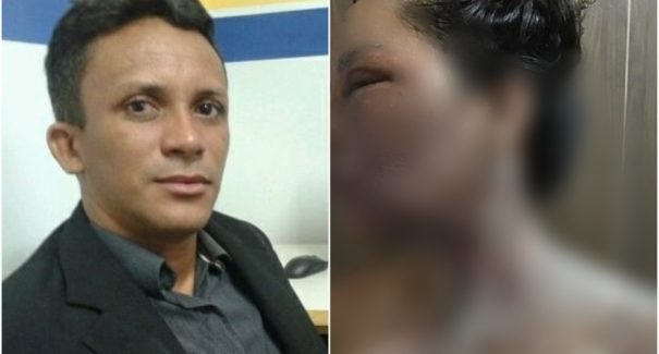 Ex-vereador que jogou água quente em esposa se entrega à polícia