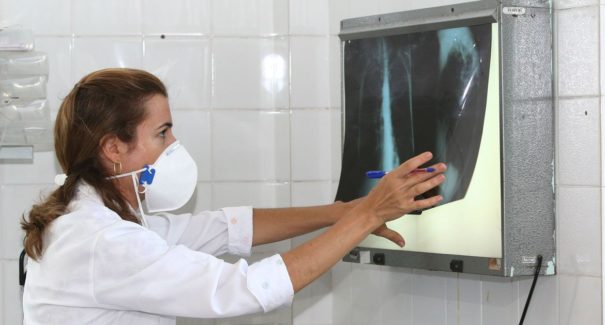 Médico alerta para riscos da tuberculose pulmonar não tratada
