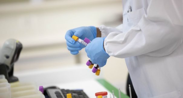 Três casos de reinfecção por covid-19 são alvo de investigações pela SES