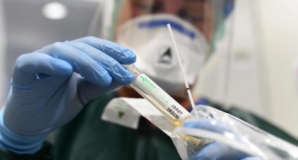 69 novos casos de covid-19 são registrados