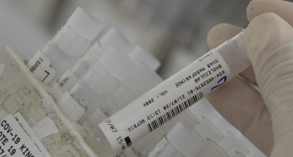 Covid-19: Brasil ultrapassa 7,5 milhões de casos