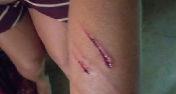 Garota de programa é agredida por advogado em Grajaú