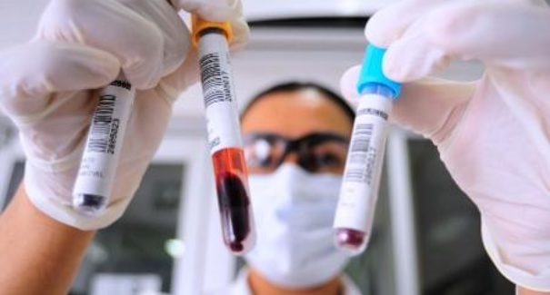Maranhão registra 203.334 mil casos do novo coronavírus
