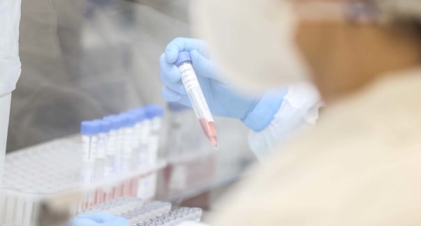 Maranhão registra mais 420 casos e 12 óbitos por Covid-19
