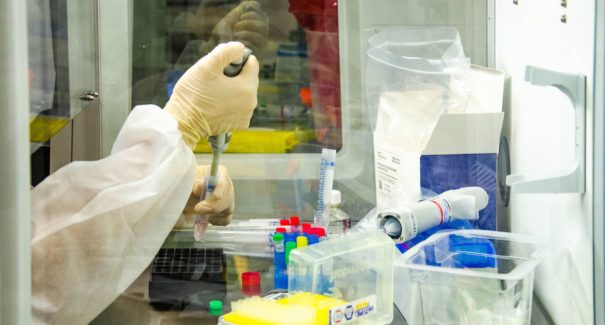 Estudo identifica substância que pode conter avanço de Parkinson