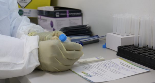 Testagem rápida para Covid-19 continua na APAE de São Luís