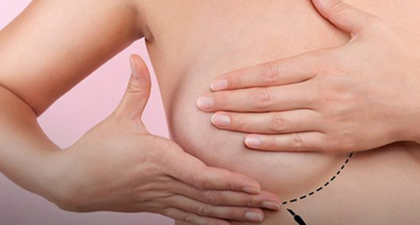 SUS agora garante mamografia para mulheres a partir de 40 anos