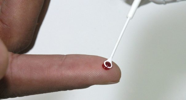 Pesquisadores desenvolvem nova abordagem para combater vírus da aids