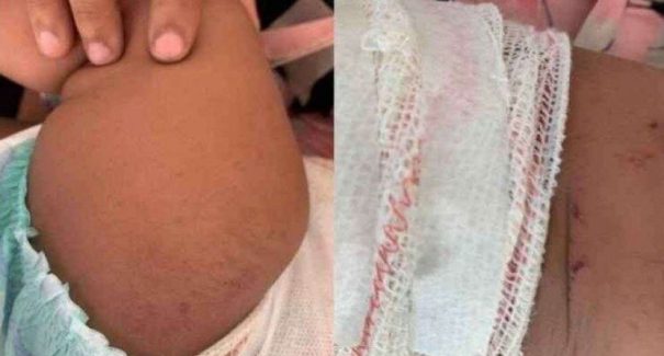 Homem atinge bebê com rojão após ser barrado em bar por não usar máscara