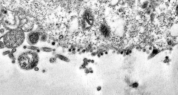 Covid-19: África do Sul detecta nova variante