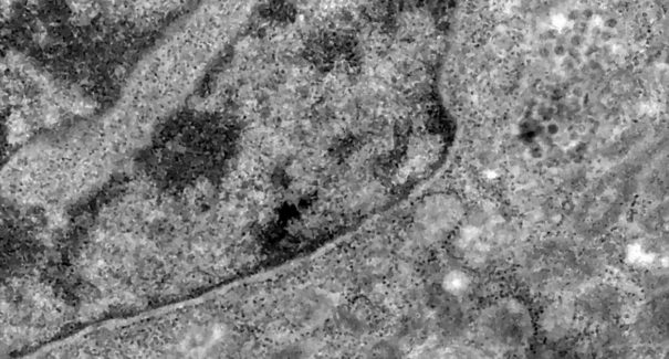 Covid-19: o que se sabe até agora da variante Ômicron