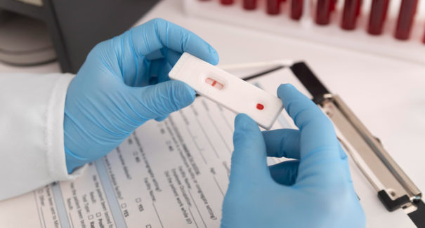 Surto de gripe Influenza A tem 1º caso confirmado no Maranhão