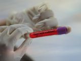 Cientistas descobrem primeiro sintoma da Ômicron diferente da gripe