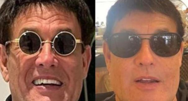 Sergio Mallandro surpreende com harmonização facial