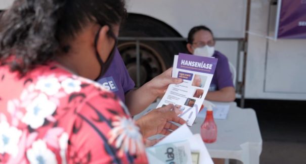 Governo e Prefeitura de São José de Ribamar iniciam atendimentos na Carreta da Hanseníase