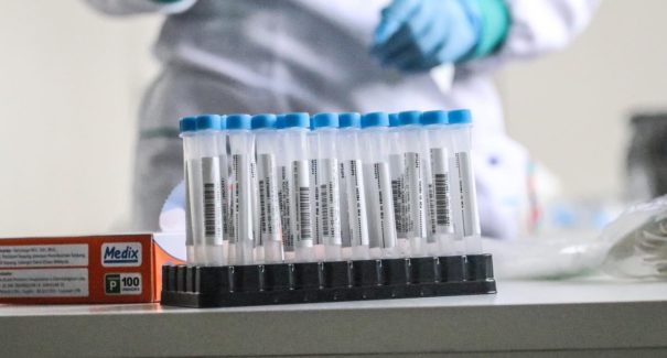 Cinco casos de covid-19 são registrados no Sampaio Corrêa