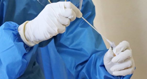 Mais 15 casos de covid-19 registrados no Sampaio Corrêa