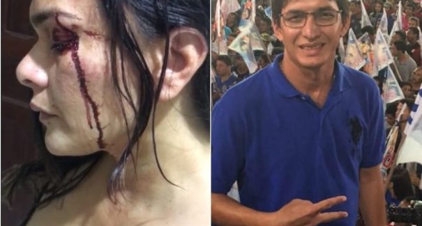 Ex-candidato a prefeito de Matinha é investigado por suspeita de agressão contra a ex-mulher