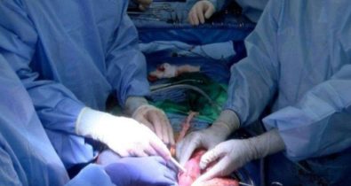 Rins de porco são transplantados em paciente com morte cerebral