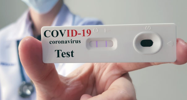 Mais de 300 mil testes de Covid serão distribuídos nos municípios maranhenses