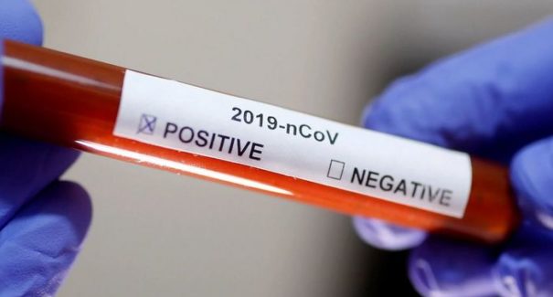 Brasil registra mais de 20 mil casos e quase 200 mortes por Covid em 24h