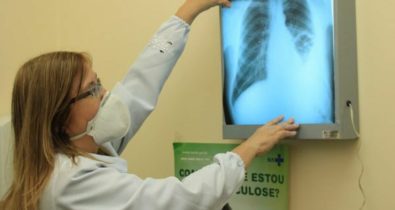 Mais de 3 mil casos de tuberculose em 2021 foram registrados no Maranhão