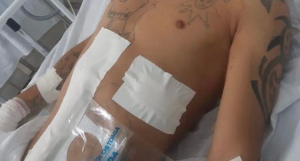 Jovem está internado após ser baleado durante encontro em Açailândia