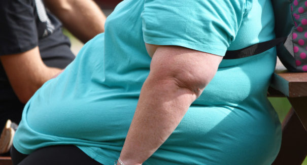 São Luís: 16% da população adulta é obesa