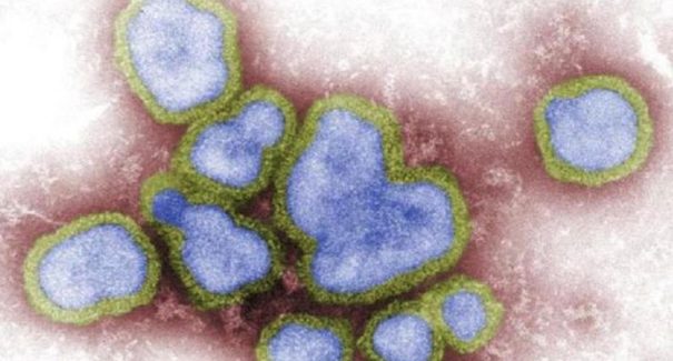 China relata primeiro caso humano de gripe aviária H3N8