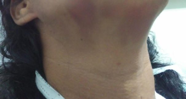 Homem é preso suspeito de tentar matar a companheira com socos e pontapés