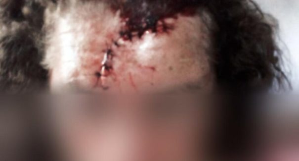 Preso homem suspeito de esfaquear mulher na cabeça