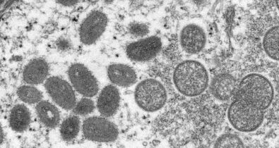 OMS confirma 257 casos de varíola dos macacos em humanos
