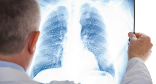 Conheça as principais doenças respiratórias