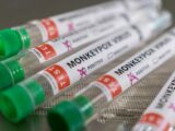 Brasil tem 17 casos confirmados para a varíola dos macacos