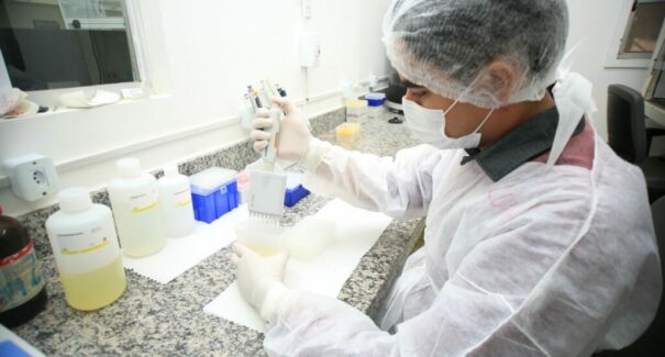 Maranhão vai reduzir tempo de diagnóstico de Monkeypox