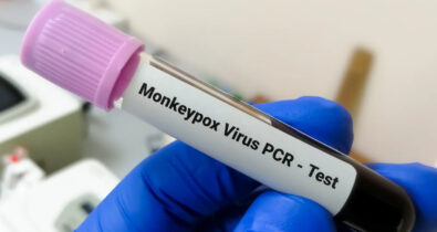 Teste para diagnóstico de varíola dos macacos é aprovado pela Anvisa
