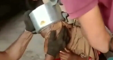 Em Coroatá, criança é resgatada após ter cabeça presa em panela de pressão