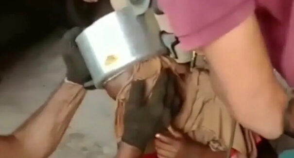 Em Coroatá, criança é resgatada após ter cabeça presa em panela de pressão