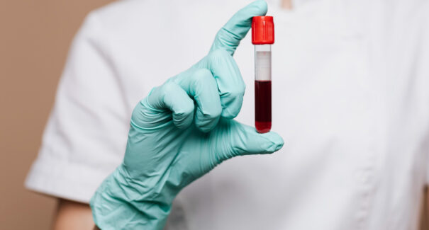 Hemomar realiza campanha para arrecadar bolsas de sangue nesta quarta-feira (25)