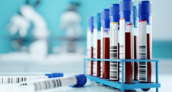 Leucemia é o sexto tipo de câncer mais frequente no Nordeste