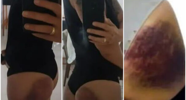 Investigadora maranhense é brutalmente agredida por instrutor durante curso no Ceará