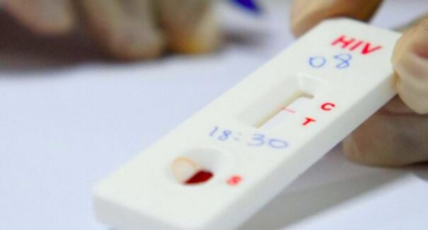 Farmácias autorizadas a realizar testes para dengue, HIV, hepatite e sífilis