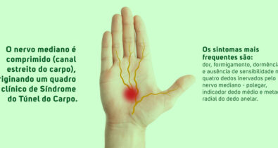 Síndrome do Túnel do Carpo: dores nas mãos merecem atenção, alerta especialista