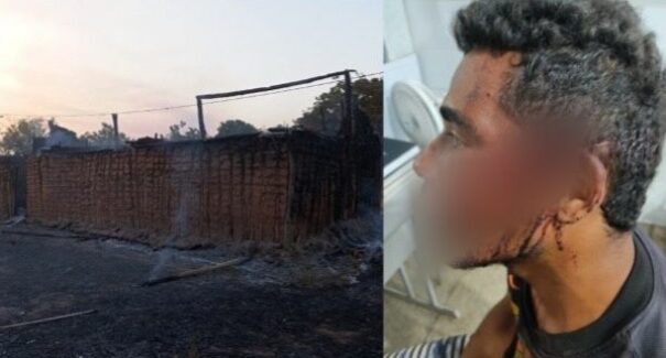 Após ser agredido, homem incendeia casa do rival com mulher e bebê dentro