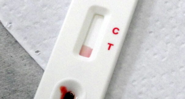 Maranhão registra quase dois mil casos de HIV em nove meses